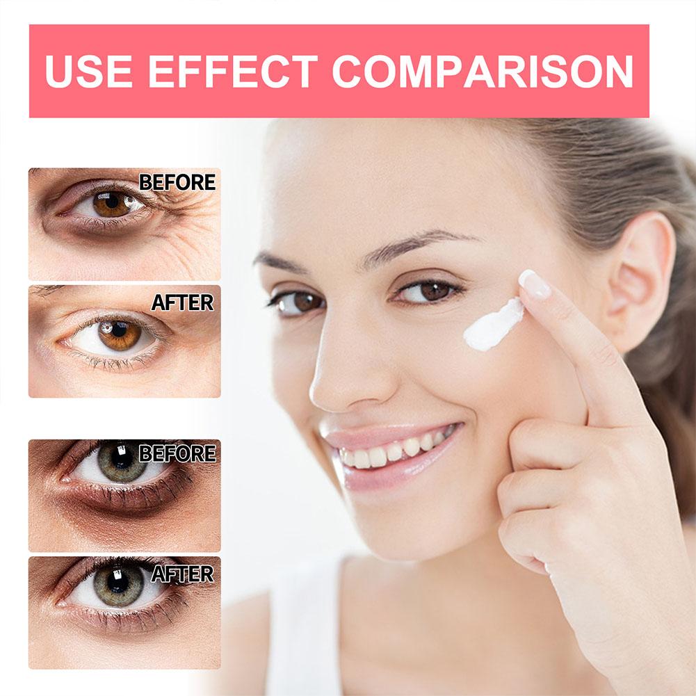 Crème pour les yeux au rétinol - The Ordinary Serum Hyaluronic Acid avis et prix